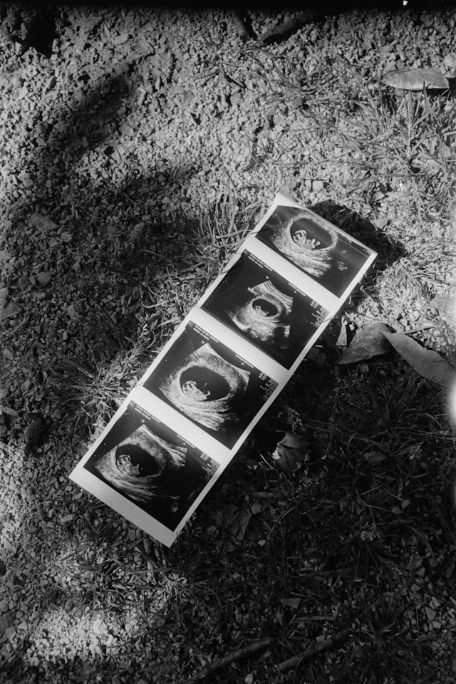 Fotos de embarazo